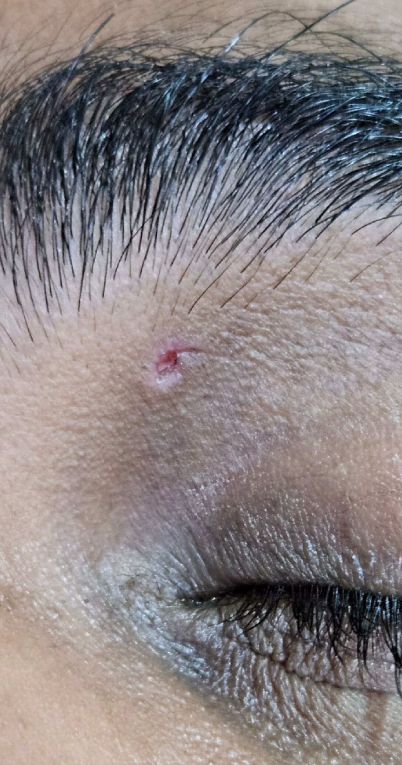 After Gum Treatment
